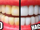 How to take care of your teeth in low budget?