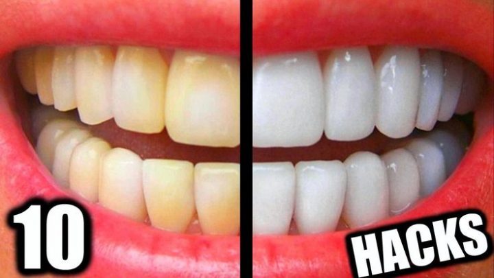 How to take care of your teeth in low budget?